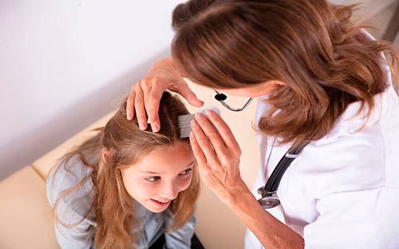 treatment of psoriasis of the head in children