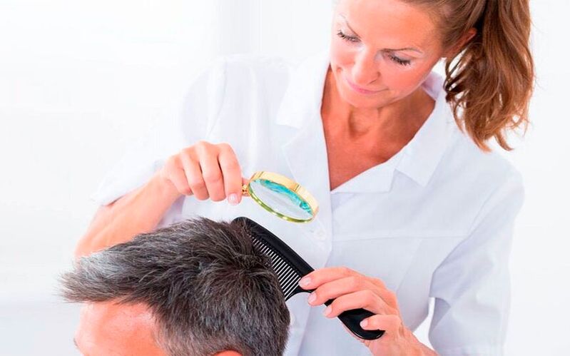 treatment of scalp psoriasis