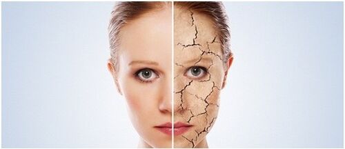 We treat psoriasis